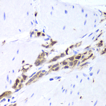 Anti-TPPP3 Antibody (CAB6775)