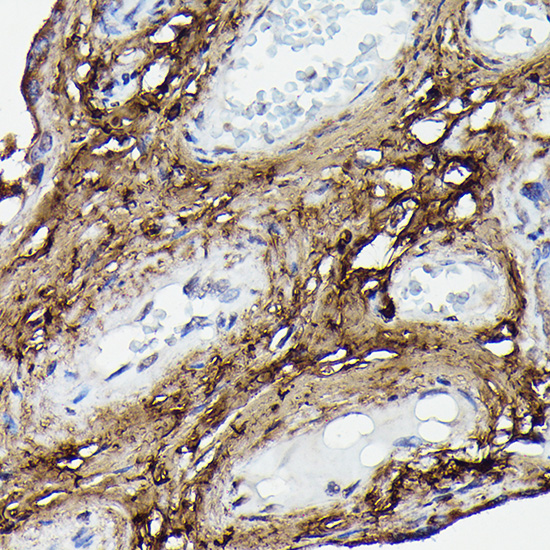 Anti-COL1A2 Antibody (CAB5786)