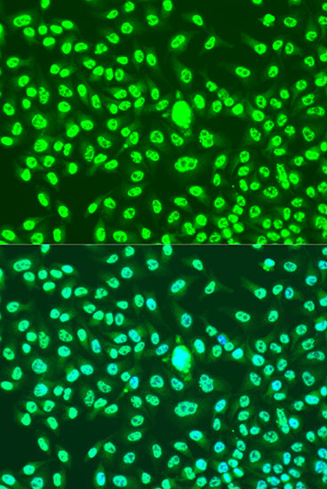 Anti-Cyclin A2 Antibody (CAB7632)