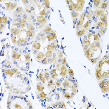 Anti-TMEM43 Polyclonal Antibody (CAB8509)