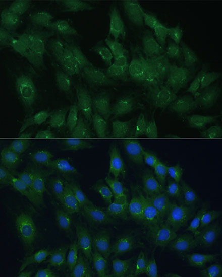 Anti-ARL1 Antibody (CAB15254)