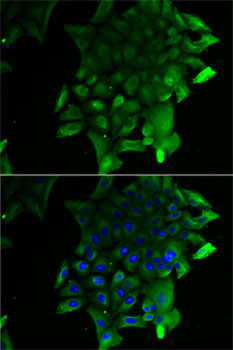 Anti-SEPSECS Antibody (CAB7103)