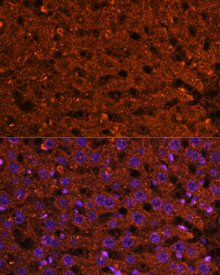 Anti-HMGCS2 Antibody (CAB14244)