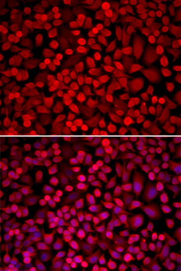 Anti-NCOA1 Antibody (CAB1128)