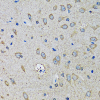 Anti-SSBP1 Antibody (CAB6987)