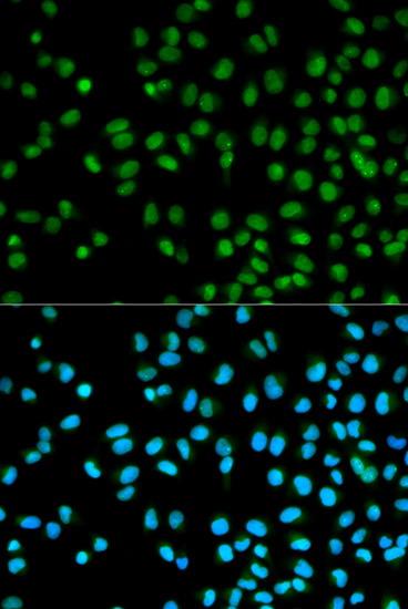 Anti-CST8 Antibody (CAB1224)