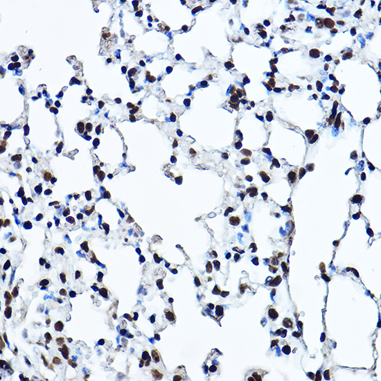 Anti-Twist Antibody [KO Validated] (CAB15596)