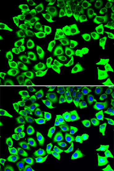 Anti-RPLP2 Antibody (CAB6974)