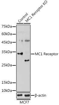 Anti-MC1 Receptor[KO Validated] Antibody