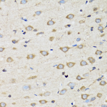 Anti-CLIC4 Antibody (CAB7088)