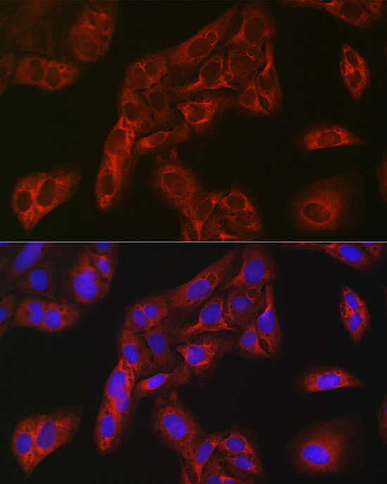 Anti-FBP1 Antibody (CAB5406)