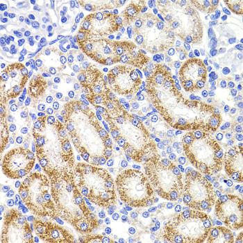 Anti-HMGCL Polyclonal Antibody (CAB8052)