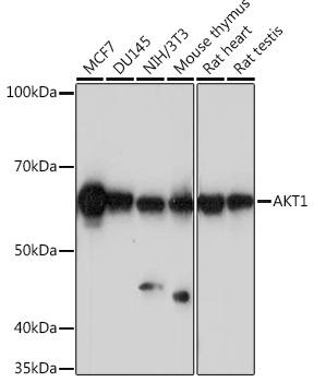 Anti-AKT1 Rabbit Monoclonal Antibody (CAB17909)