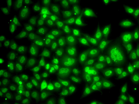 Anti-TBL1XR1 Antibody (CAB13438)