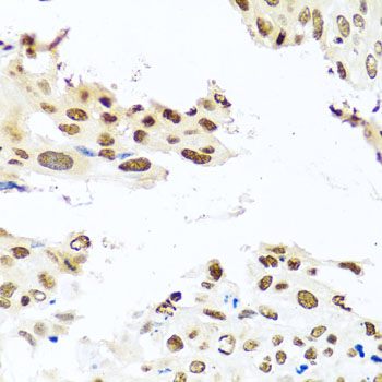 Anti-RAB3IP Polyclonal Antibody (CAB8094)
