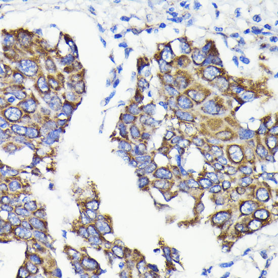 Anti-TTC11 Antibody [KO Validated] (CAB19666)