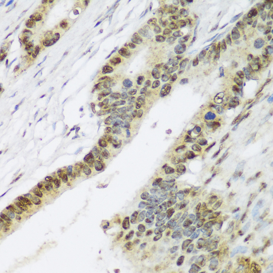 Anti-DPY30 Antibody (CAB17796)