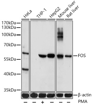 Anti-FOS Antibody (CAB17351)