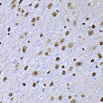 Anti-SOX5 Antibody (CAB6985)