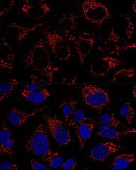 Anti-TFAM Antibody (CAB1926)