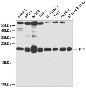 Anti-TPT1 Antibody (CAB5442)