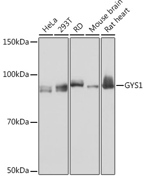 Anti-GYS1 Antibody (CAB8912)