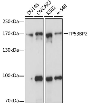 Anti-TP53BP2 Antibody (CAB15105)