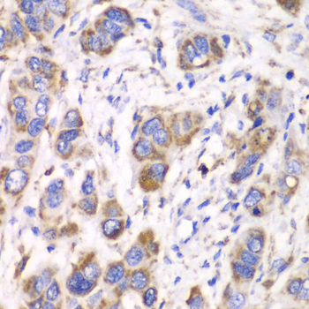 Anti-ALDH2 Antibody (CAB1226)