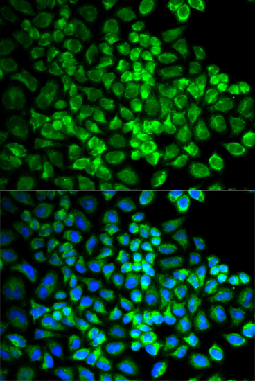 Anti-GRIA3 Antibody (CAB1159)