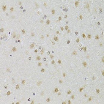 Anti-HEXIM1 Antibody (CAB5775)