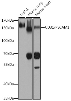 Anti-CD31/PECAM1 Antibody (CAB3181)