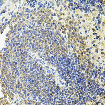 Anti-RALBP1 Antibody [KO Validated] (CAB1140)