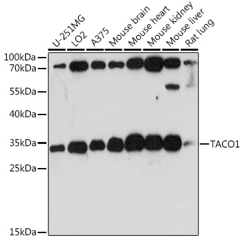 Anti-TACO1 Antibody (CAB15445)