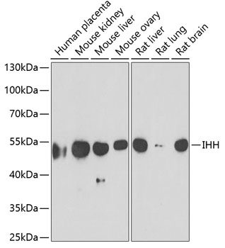 Anti-IHH Antibody (CAB6626)