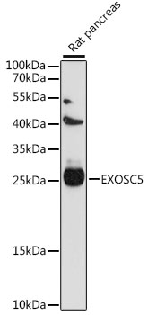 Anti-EXOSC5 Antibody (CAB15870)