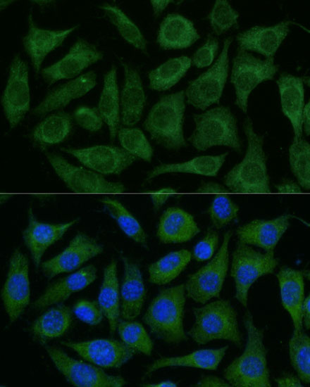 Anti-RAPGEF1 Antibody (CAB16050)