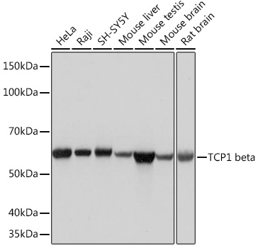 Anti-TCP1 beta Antibody (CAB4700)