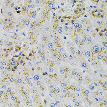 Anti-AARS Antibody (CAB7864)