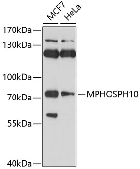 Anti-MPHOSPH10 Antibody (CAB10041)