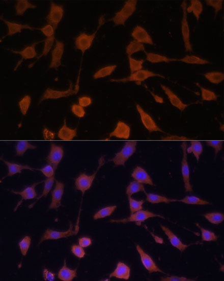 Anti-Bax Antibody [KO Validated] (CAB11550)