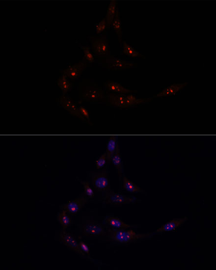 Anti-METTL16 Antibody (CAB15894)