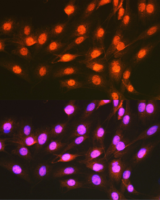 Anti-PCBP1 Antibody (CAB1044)