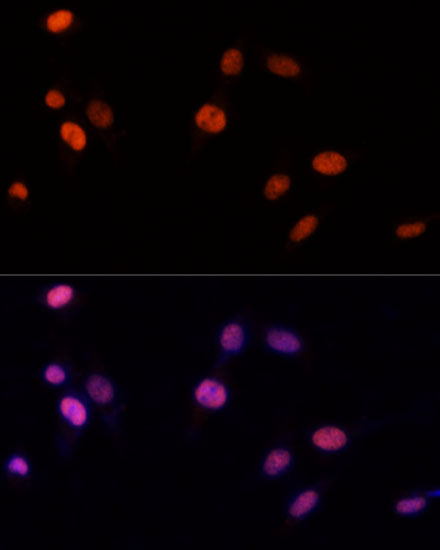 Anti-PSME3 Antibody (CAB12697)