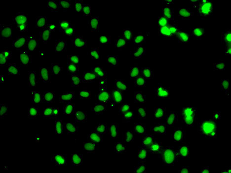 Anti-HMG20A Antibody (CAB7286)