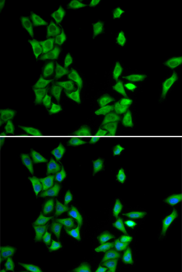 Anti-ANXA4 Antibody (CAB13466)