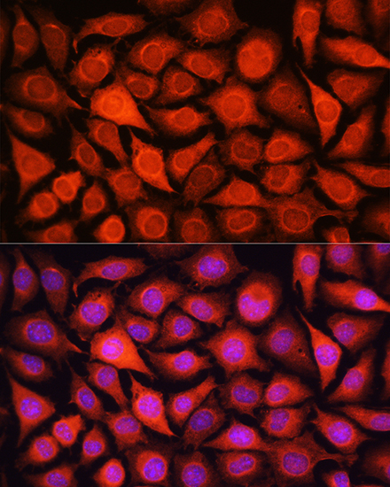 Anti-LDHA Antibody (CAB16394)