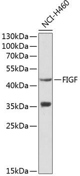 Anti-FIGF Antibody (CAB1194)