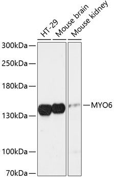 Anti-MYO6 Antibody (CAB13033)