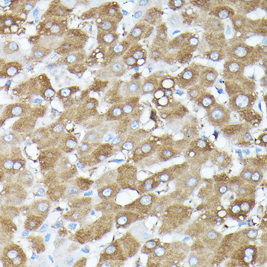 Anti-MLST8 Antibody (CAB13599)