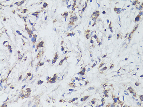 Anti-TrkB Antibody (CAB12011)